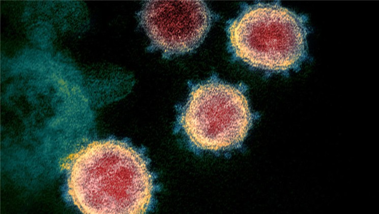 No, the Coronavirus Wasn’t Made in A Lab. A Genetic Analysis Shows It’s from Nature