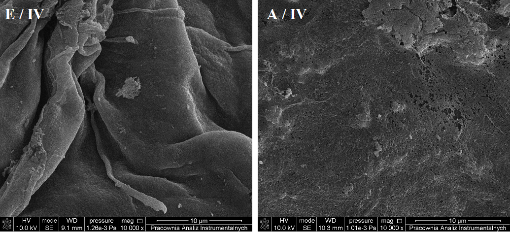 Swelling Properties of Biodegradable Superabsorbent Polymers